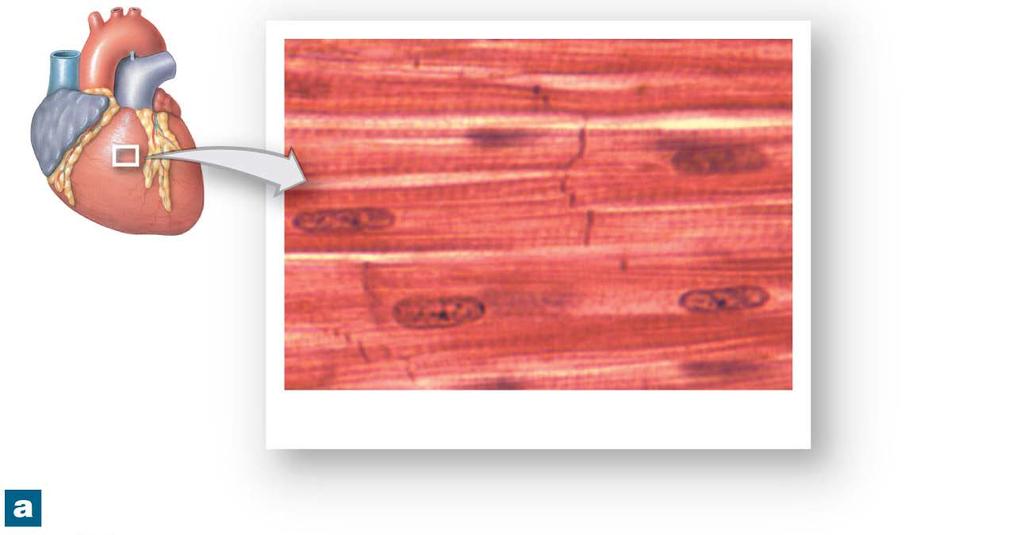Figure 10-22a Cardiac Muscle Tissue Cardiac muscle cell Intercalated discs
