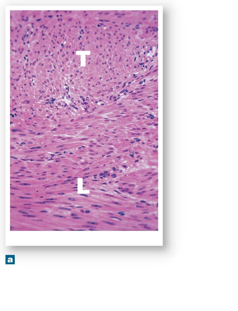 Figure 10-23a Smooth Muscle Tissue Circular muscle layer Longitudinal muscle layer Smooth muscle tissue LM 100 Many visceral organs contain several layers of