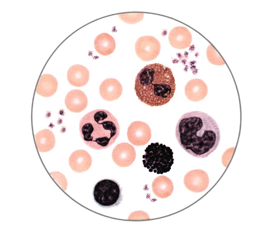 CHAPTER 15 CLINICAL INVESTIGATIONS JOOP P VAN DE MERWE - SJÖGREN S SYNDROME: INFORMATION FOR PATIENTS AND PROFESSIONALS eosinophilic granulocyte platelets other factors that influence the ESR.