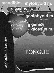 muscles of the floor of the oral cavity: geniohyoid muscle, tongue,
