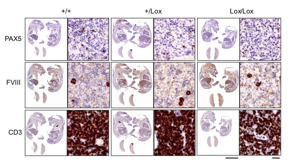 Supplementary Figure 5. IHC stainings of mature hematopoietic populations in fetal liver and thymus.