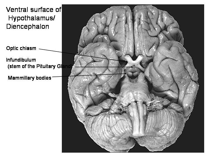 4. Basal Ganglia From an anatomist s point of view (our definition): Basal ganglia are all subcortical structures