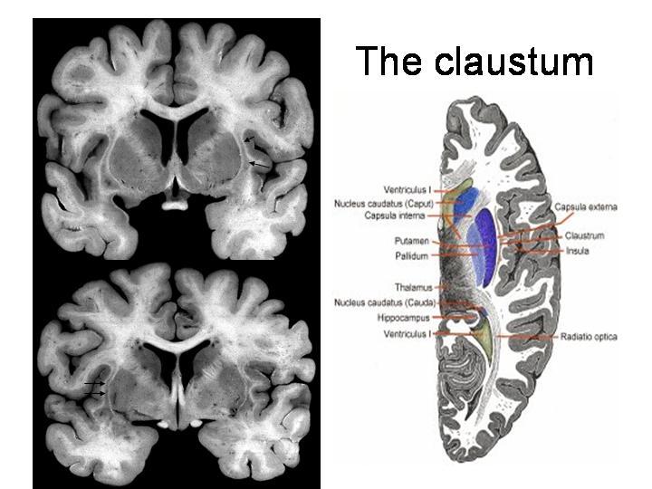 Naming issues Corpus striatum (largest component of the basal ganglia) this
