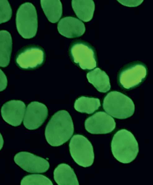 Autoantibodies against cell nuclei, homogeneous (AC-1) show a homogeneous fluorescence of the cell nuclei.