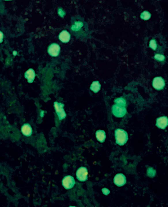 On the substrate primate liver a homogeneous, partly coarse to fine clumpy fluorescence of the cell nuclei can be