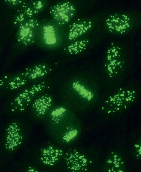 Autoantibodies against centromeres (AC-3) show a very specific fluorescence pattern, which is characterised by fine, evenly sized granules (generally 46 or 92 centromeres per cell nucleus).