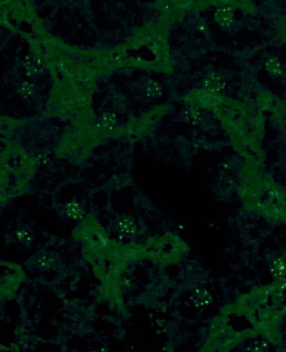 approaching the centrioles (anaphase). On tissue sections of primate liver 10 to 20 granules, which are spread over the cell nucleus, can be seen.