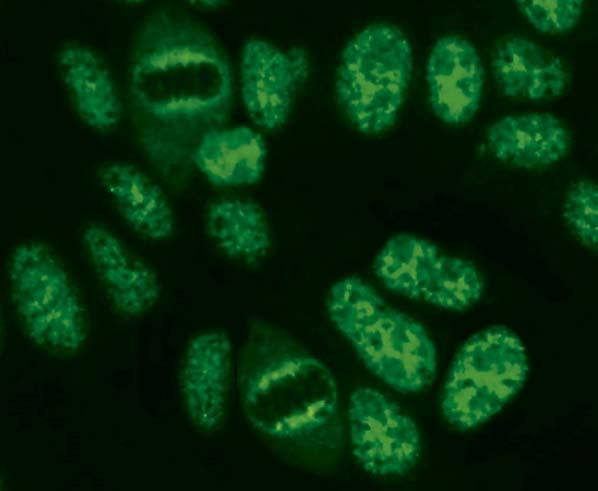 Autoantibodies against nucleoplasm, fine speckled (AC-4) show a fine speckled fluorescence of the cell nuclei in the interphase.