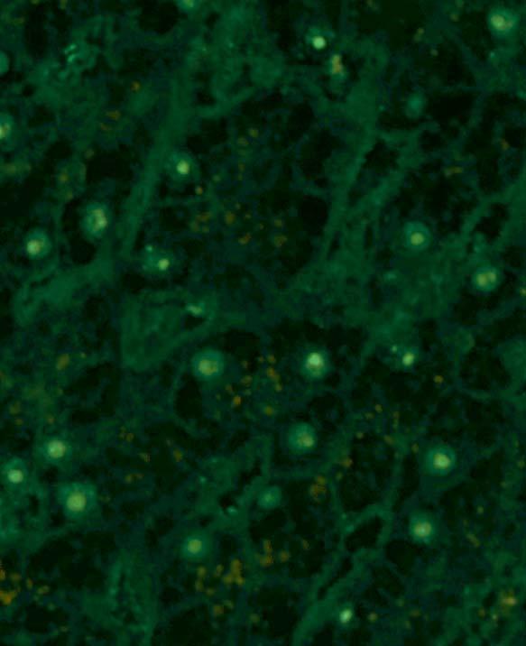 Mitotic cells show a speckled fluorescence, with the chromosomes excluded.