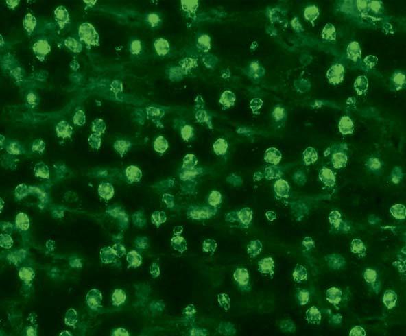 Autoantibodies against Ku (AC-4) In the indirect immunofluorescence test with, antibodies against Ku exhibit a fine speckled fluorescence of the cell nuclei and the nucleoli are positive in parts.