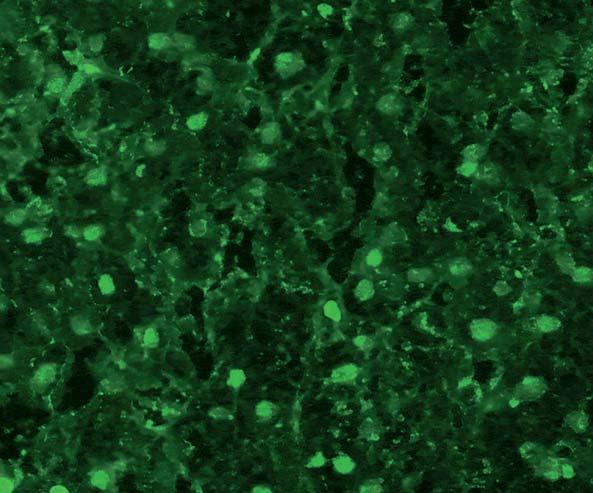 With primate liver, autoantibodies against Mi-2 depict a fine speckled fluorescence of the hepatocyte nuclei.