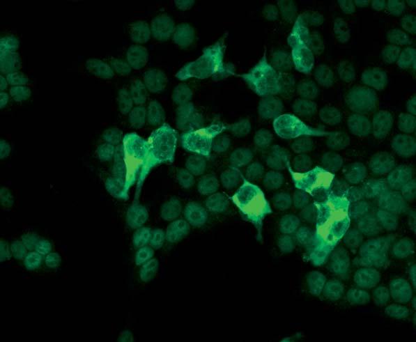 Antibodies against TIF1-gamma react with the transfected cells of the test substrate. They produce a smooth to fine speckled fluorescence in the cytoplasm.