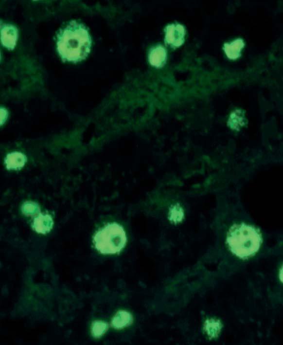 In mitotic cells the condensed chromosomes are dark, while the periphery shows an almost homogeneous, smooth fluorescence.