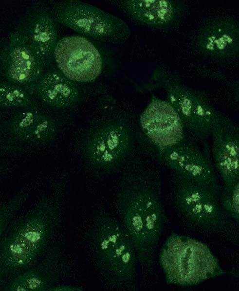 Autoantibodies against U3-nRNP / fibrillarin (AC-9) On interphase cells show a speckled fluorescence of