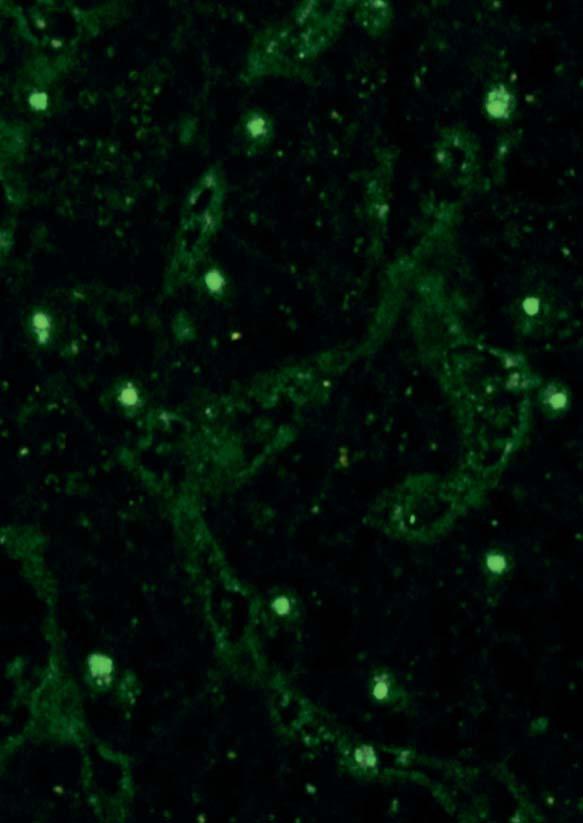 The substrate primate liver depicts a homogeneous fluorescence of the cell nuclei.