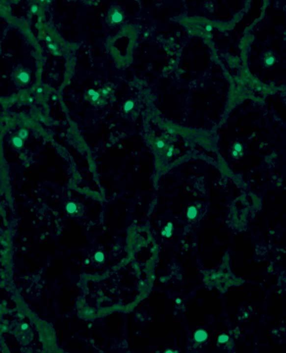 If autoantibodies against NOR-90 occur in parallel, one to several dots fluoresce on mitotic cells.