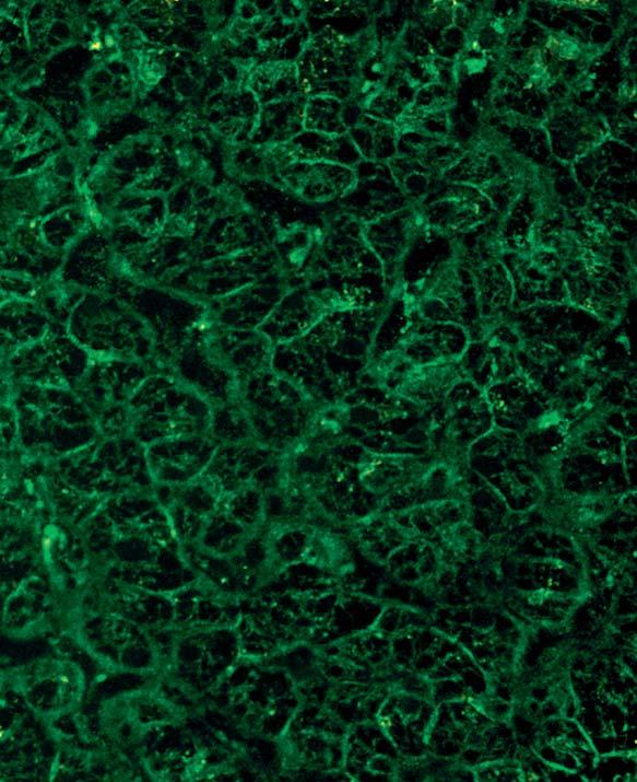 These are probably condensed vimentin. On tissue sections of primate liver there is an unspecific fluorescence.