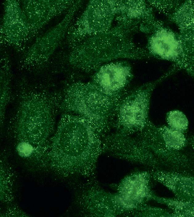 Autoantibodies against Jo-1 (AC-20) Antibodies against Jo-1 show a fine speckled to homogenous cytoplasmic fluorescence on. The cell nuclei also show distinct sharp dots in many cases.