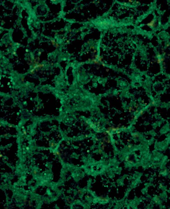 On frozen tissue sections of primate liver the cytoplasm is only slightly stained. The fluorescence cannot be used for diagnostics.