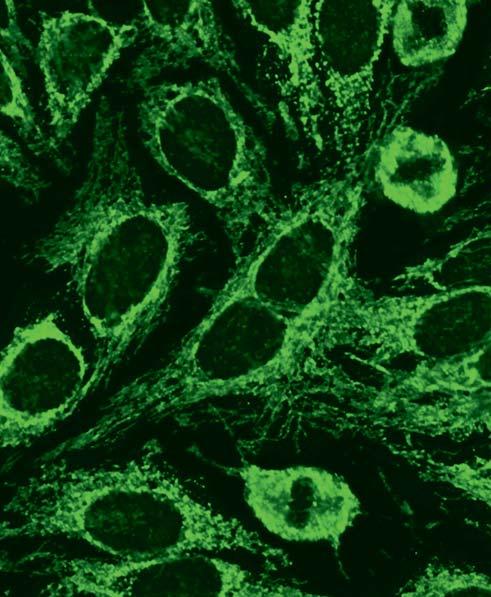 Autoantibodies against mitochondria (AC-21) HEp-2-cells contain the antigens M2, M3, M5 and M9; here the antibodies produce a coarse speckled fluorescence of the cytoplasm which does not include the