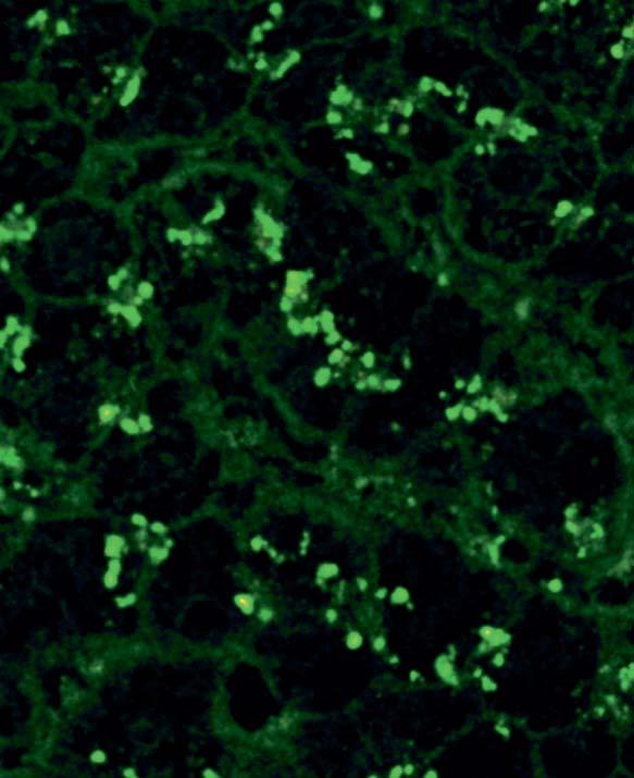 On primate liver the cytoplasm of hepatocytes is also stained. Known target antigens: Giantin / macrogolgin, golgin-95 / GM130, golgin-160, golgin-97 and golgin-245.