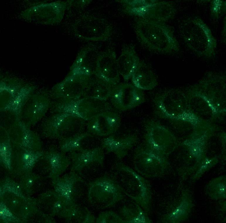 Autoantibodies against centrosomes (AC-24) A typical positive result is characterised by fluorescing centrosomes in the cytoplasm of, namely one or two