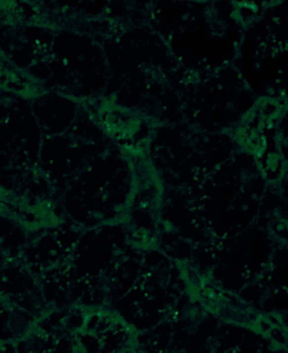 On primate liver, high-titer samples produce small fluorescing dots in the cytoplasm of hepatocytes.