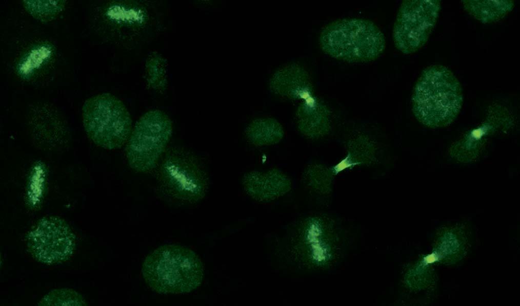 Autoantibodies against midbody (AC-27) In the indirect immunofluorescence test, in the metaphase of mitosis show a fine speckled fluorescence of the equatorial plane in the presence of midbody