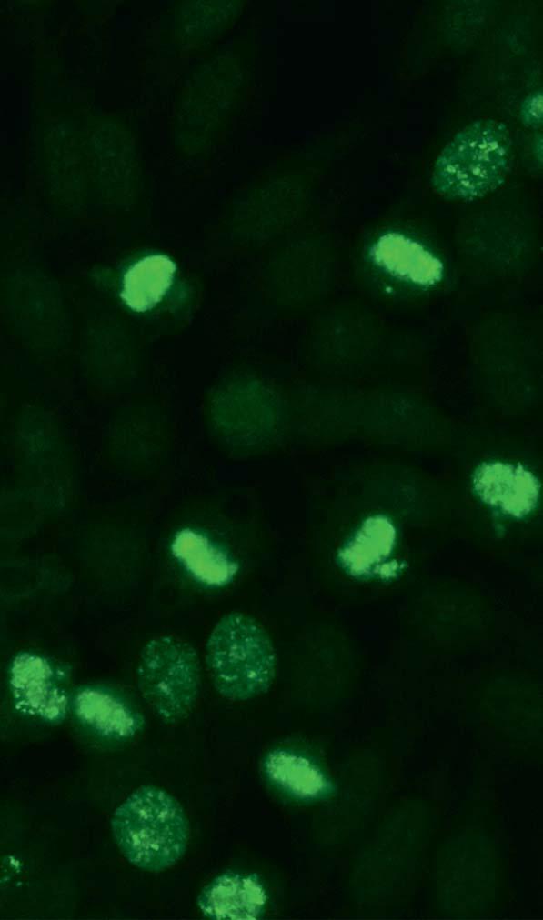 Autoantibodies against MCA (AC-28) On Hep-2 cells, the chromosomes in the pro- and methaphase show a dotted fluorescence. Interphase nuclei do not present any staining.