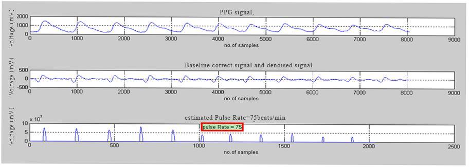 80 Figure 4.12 Preprocessing of PPG signal and pulse rate estimation 4.8.6 Pulse Transit Time and SBP Estimation In Figure 4.