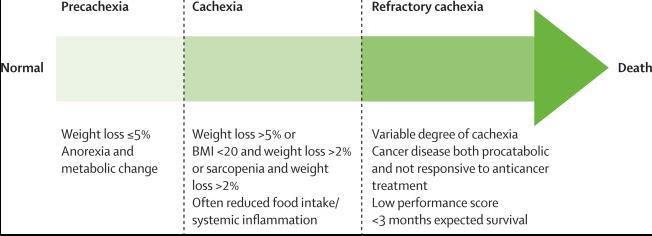 Definition and classification of cancer cachexia: an