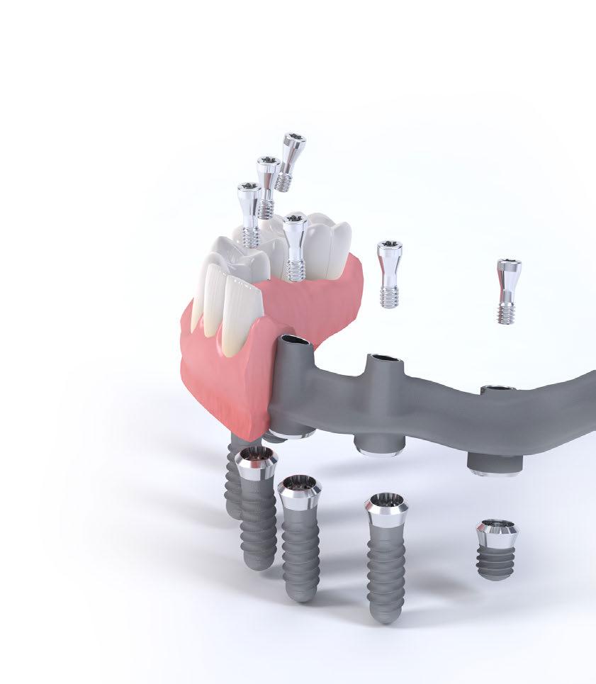 2. Technical information The Straumann Standard Plus Short (SPS) Implant, at 4 mm length, is the shortest screw-type implant with internal connection on the market.