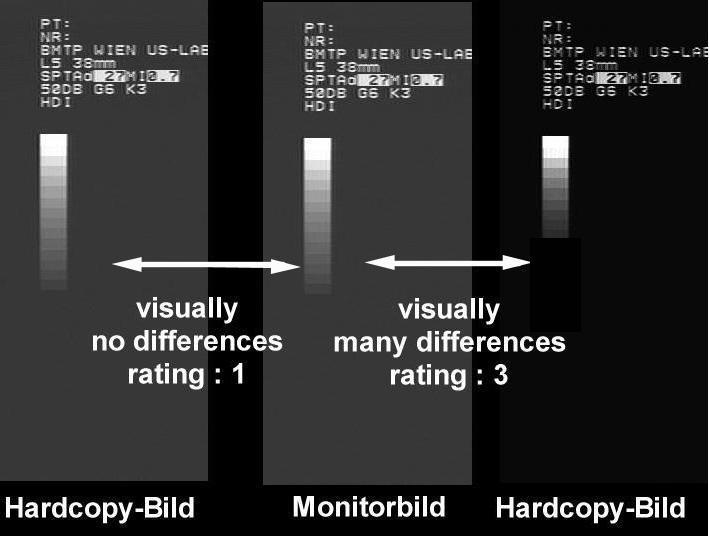 4 Grey-level comparison between Monitor and Hardcopy-unit (printer) (images) Abb. 4 : Ultrasound images / Example of a visual evaluation.
