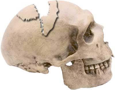 8. Skulls protect the brain from damage. The skull acts as a helmet for the brain. What happened to this skull to cause death? Injury Old Age Growth Flow 9.
