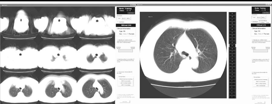 Figure 1. (a) Example of the multiformat display used by the six radiologists in group 1.
