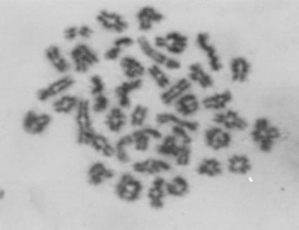 chromosomes with high activity.