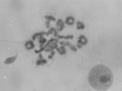 b) Photomicrograph showing mice chromosomes