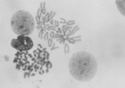 f) Photomicrograph showing polyploid 