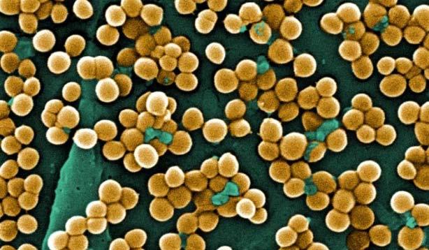 Bacteria responsible Pseudomonas aeroginosa Staphylococcus aureaus Proteus