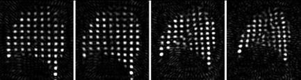 Volumetric Cine (VC) MRI for IGRT Volumetric cine (VC) images are estimated from prior 4D