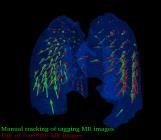 images in brain and body sites Readout-segmented, multi-shot