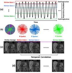 Compatible with MRI data obtained with different pulse sequences Respiratory