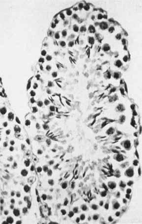 PITUITARY HYPERPLASIA IN A MALE MOUSE 745 active spermatogenesis is in progress, though the spermatozoa are not completely developed (Fig. 6).