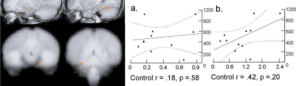 Study I: Brain activation clusters associated with average eye-fixation time
