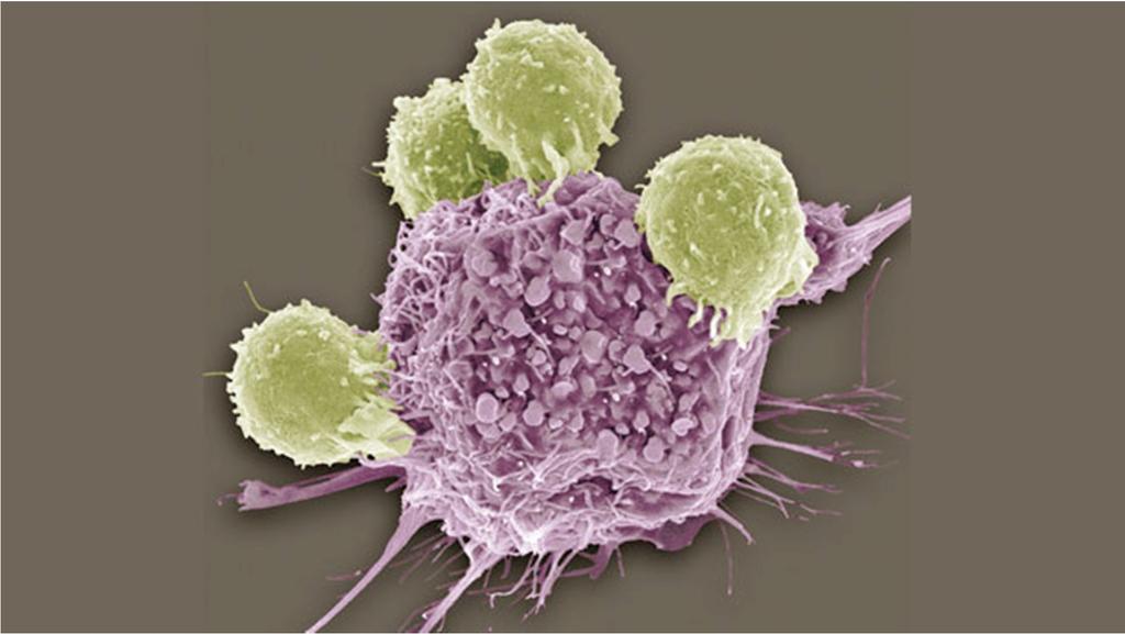 Successful anti-cancer immunity is