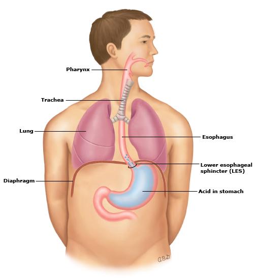 Page 9 of 10 GRAPHICS Gastroesophageal reflux disease (GERD) When we eat, food is carried from the mouth through the esophagus, a tube-like structure that is approximately 10 inches long and 1 inch
