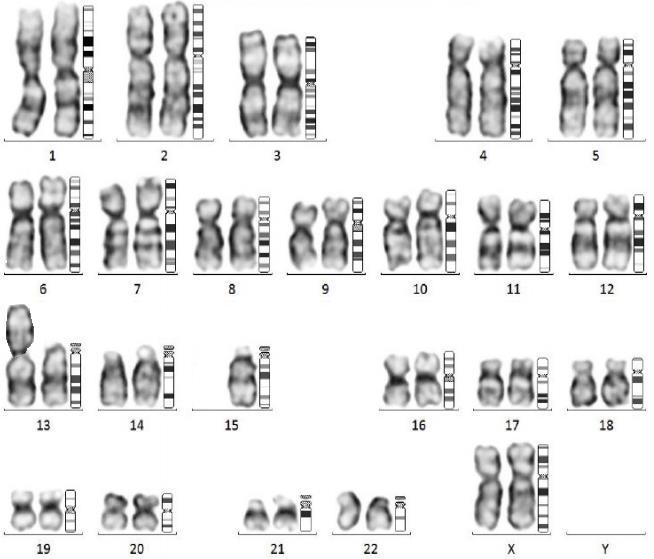 The representative karyograms depicting major type of chromosomal of typical abnormalities