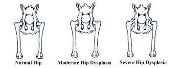 Dysplasia Hip Dysplasia is a fairly common condition in both adolescents and adults.