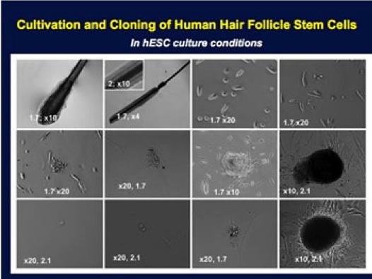 Multi-Potent Dermal Cells Multipotent dermal stem cells, isolated from human foreskins, lacking hair follicles, are able to home to the epidermis to differentiate into melanocytes.