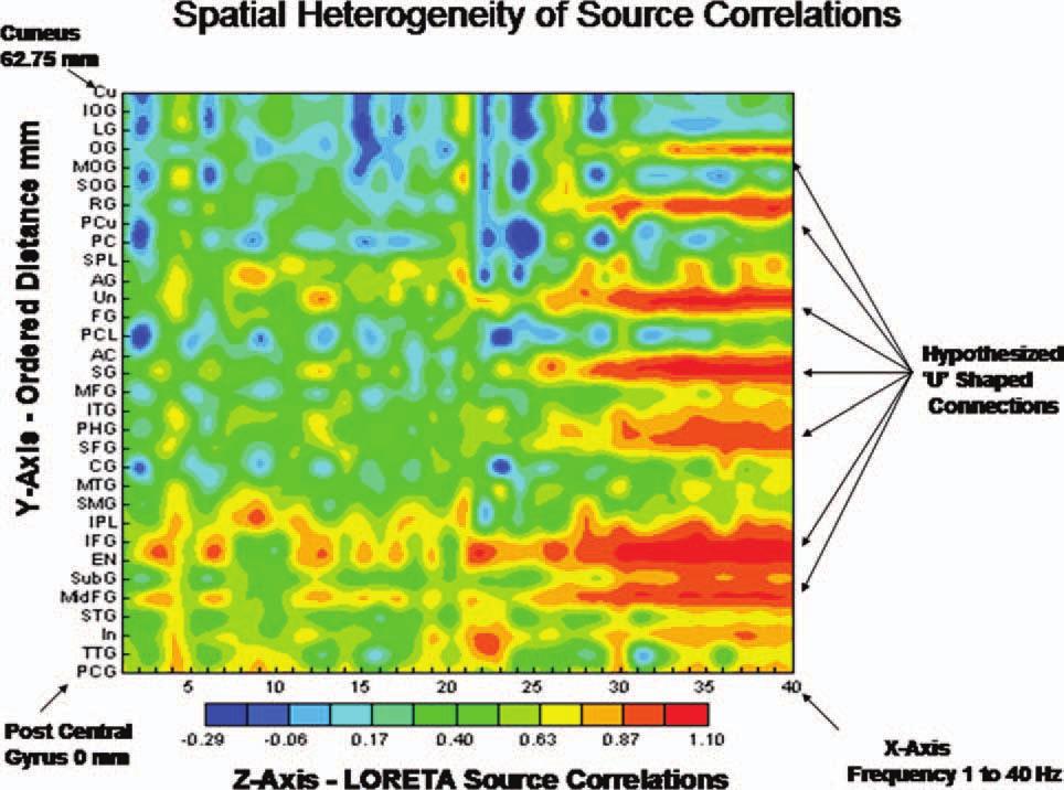 r EEG and Diffusion Spectral Imaging Modules r From Thatcher et al.